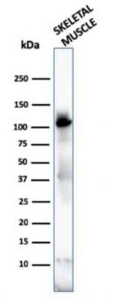 Alpha Actinin 2, Mouse anti-Human, Clone: ACTN2/3292, Novus Biologicals